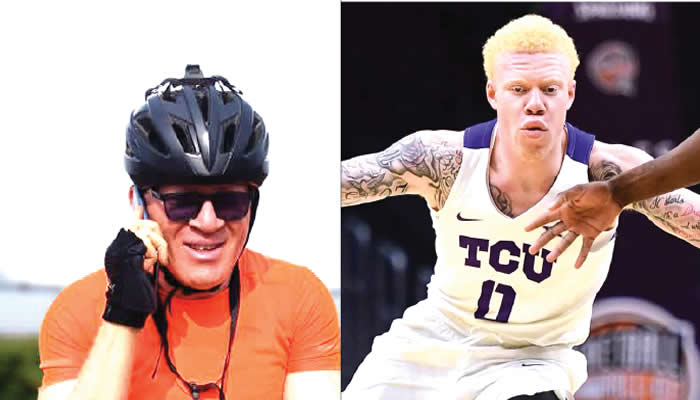 Breaking Boundaries: The Emergence of Athletes with Albinism in Sports Despite Stigma
