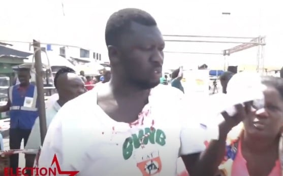 Violence Erupts in Odododiodio Constituency During 2024 Election, Resulting in Voter Injury