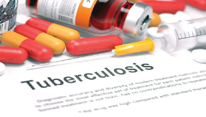 Federal Government Asserts Tuberculosis Has Non-Spiritual Origins